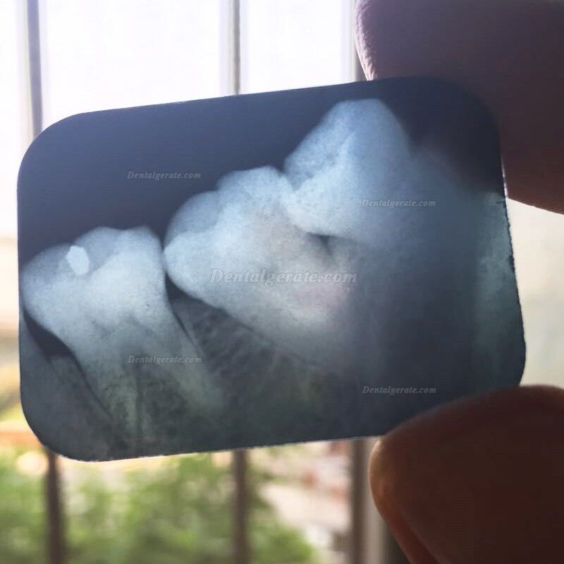 TIANJIE&reg; BLX-10 Mobiles Digitale R&ouml;ntgenger&auml;t Zahnarzt Tragbares Zahn&auml;rztliches R&ouml;ntgenger&auml;t